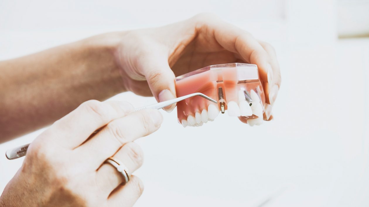 Dental Implant surgery