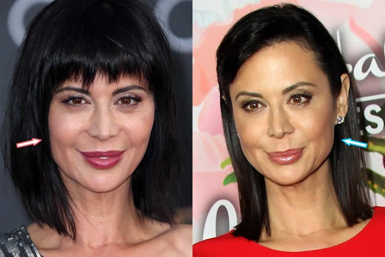 Catherine Bell Plastic Surgery A Truth or A Rumor.