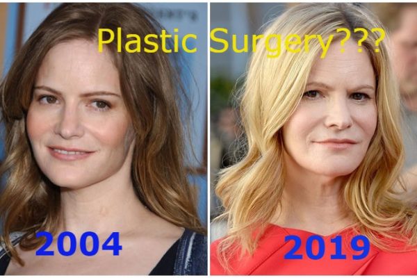 Jennifer Jason Leigh Plastic Surgery