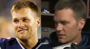 Tom Brady Plastic Surgery A Phenomenon To Understand From The Very Beginning