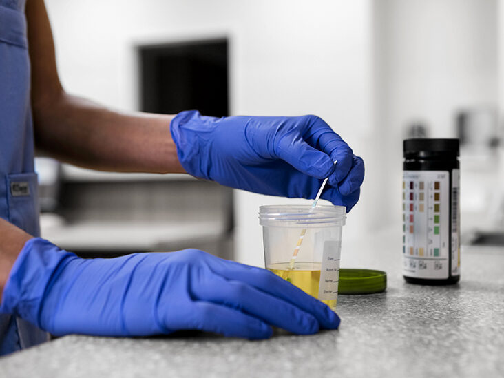 What Are The Most Common Types Of Drug Testing? And Their Differences