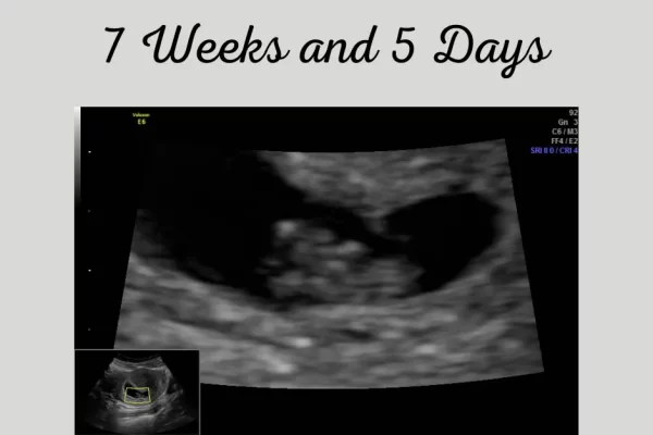 Ultrasound Week 7
